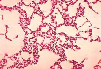 Sporebiotics:  The latest innovation in probiotics - SDBrainCenter