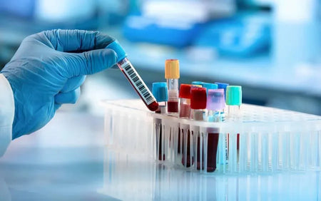 Gloved hand holding blood sample vial among lab test tubes in medical laboratory setting.